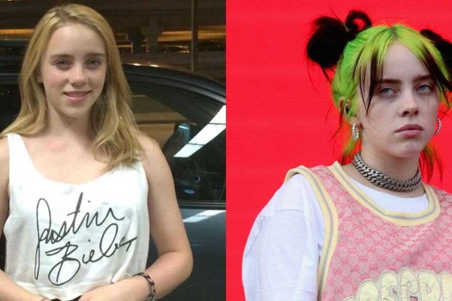 Billie Eilish Plastic Surgery Speculation