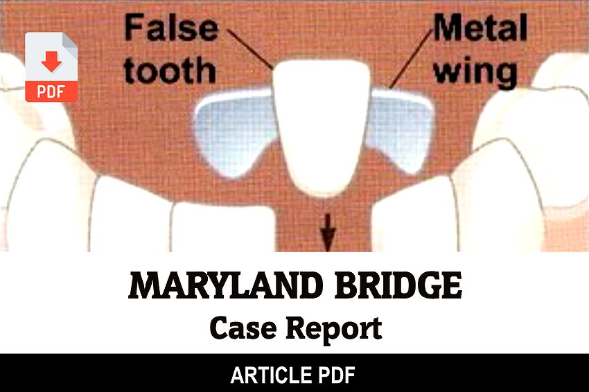 PDF Maryland Bridge Case Report