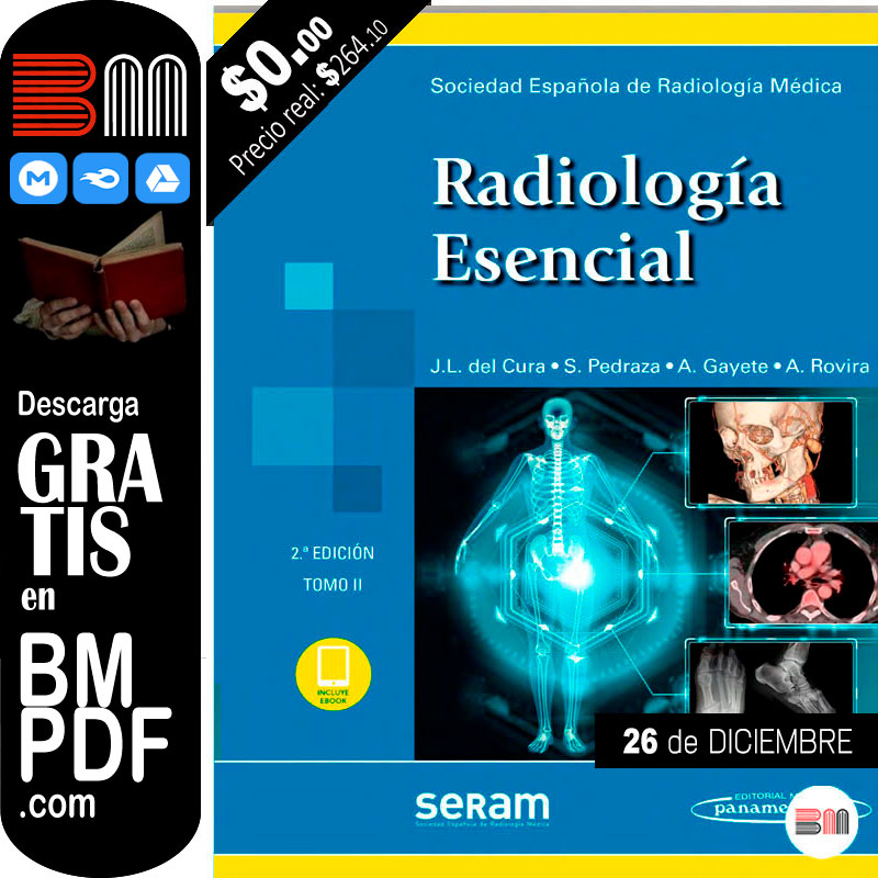 Radiología Esencial 2da edición TOMO 2 PDF