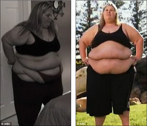 Dailyceleb When You Re Bigger Than The Biggest Person On The Biggest Loser It S Horrible How Mother Of Two Lost 200lb In A Year
