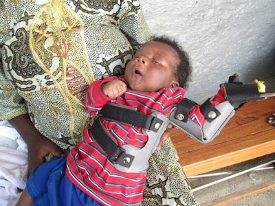 बच्चे विकलांग क्यों होते हैं, जबकि प्रेगनेंसी में कोई प्रॉब्लम नहीं थी