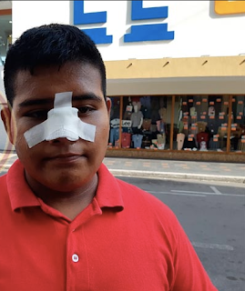 Le fracturan la nariz a joven en CBTIS de Veracruz. Noticias en tiempo real