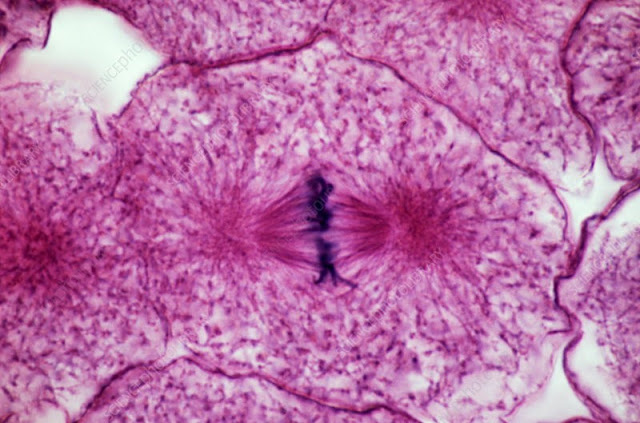 Sel saat metafase di bawah mikroskop
