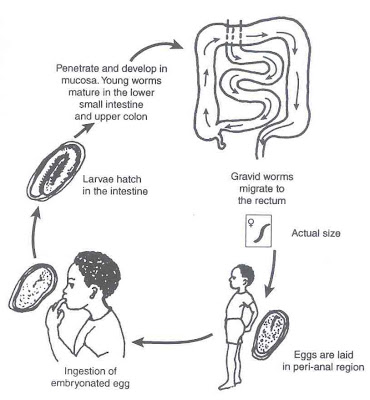 Oxyuris vermicularis menyebabkan penyakit, Oxyuris vermicularis menyebabkan penyakit