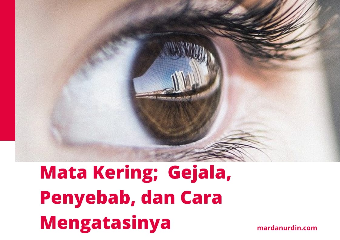 Kening kanan berdenyut