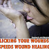 Licking Your Wounds: Scientists Isolate Compound In Human Saliva That Speeds Wound Healing