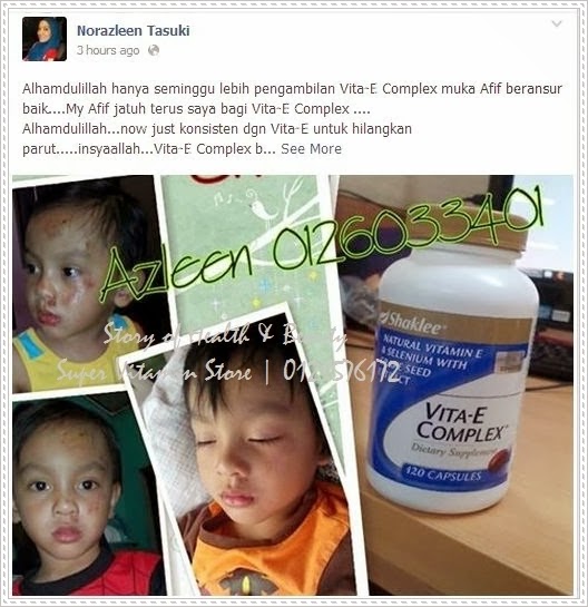 Testimoni vitamin E Shaklee untuk kulit