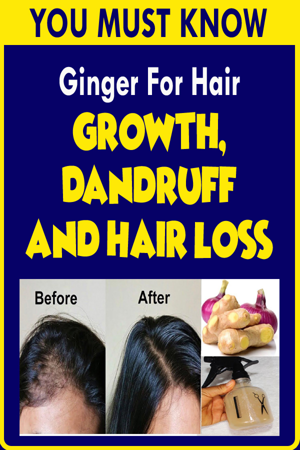 Ginger For Hair Growth, Dandruff And Hair Loss