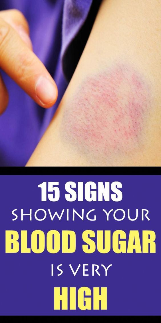 diabates remedies during pregnancy how to control sugar level high