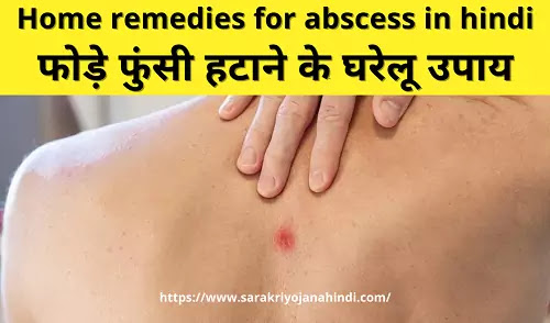 फोड़े फुंसी हटाने के घरेलू उपाय-home remedies for abscess in hindi
