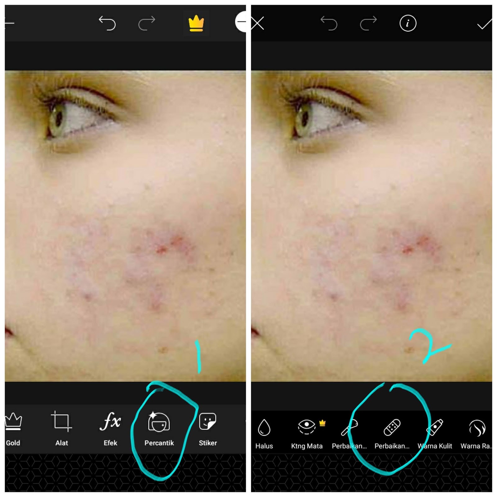Cara Edit Foto Menghilangkan Flek Hitam Dan Bekas Jerawat Picsart Tutorial Tutorialduaenam