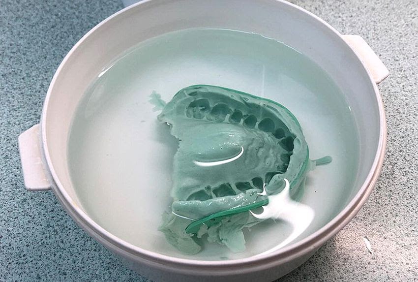 PDF An Overview of Dental Impression Disinfection Techniques A