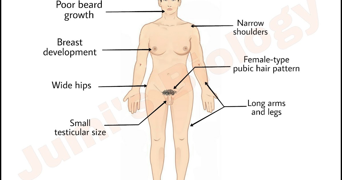 Klinefelters Syndrome Causes And Symptoms Class 12 Biology
