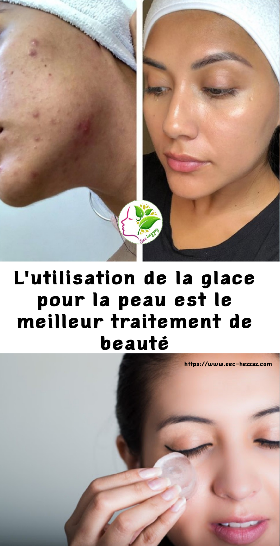 L'utilisation de la glace pour la peau est le meilleur traitement de beauté