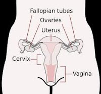 penyebab dan jenis kista ovarium