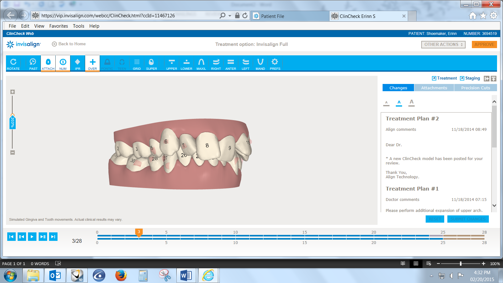 Gettysburg Dental Associates Erinn's Invisalign Journey