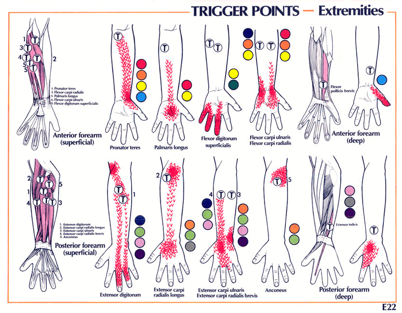 MAKLUMAT KESIHATAN DAN PENYAKIT Trigger Point Referral Patterns