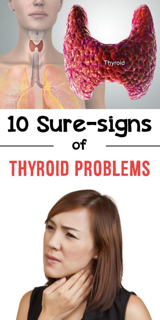 thyroid issues thyroid issues