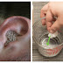 Stop Using Cotton Buds Immediately: Doctor Discovered The Most Effective Way For Cleaning Your Ears
