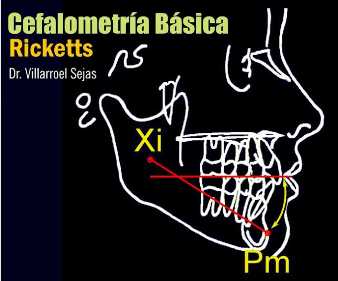 ORTODONCIA: Cefalometría Básica 2 (Ricketts) - Dr. Villarroel Sejas
