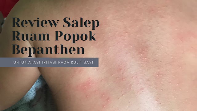 review salep ruam popok, salep popok bayi, salep ruam popok, salep untuk bayi, review bepanthen, bepanthen, bepanthen salep ruam popok, harga salep bepanthen, beli bepanthen, ruam popok, cara mencegah ruam popok