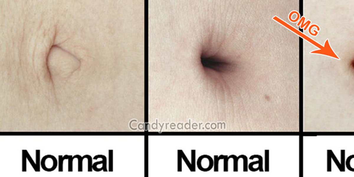 Omg 10 Bizarre Facts About Belly Button You Cannot Even Imagine The
