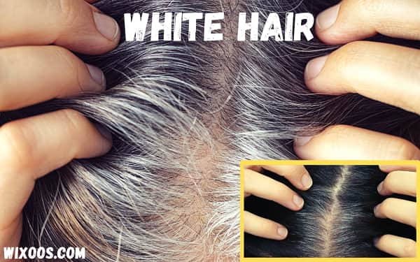 White hair, the phenomenon is reversible: Link with stress
