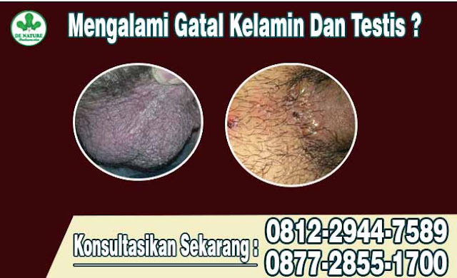 obat gatal seperti dompo di kelamin pria