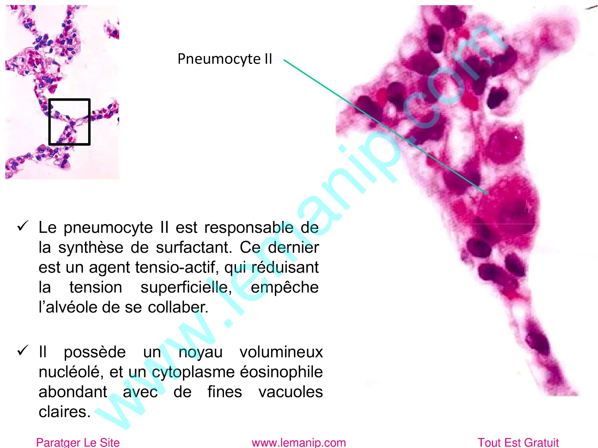 Pneumocyte II