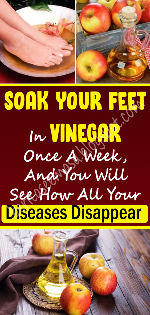 Soak Your Feet In Vinegar Once A Week, And You Will See How All Your