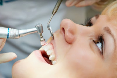 Nhổ răng khểnh có nguy hiểm không?