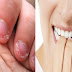 7 Best Tips To Stop Nail Biting 