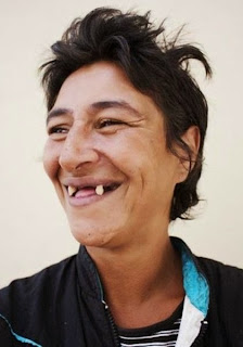 dientes feos humor