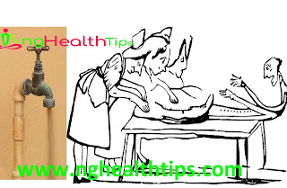 Cholera Disease in Nigeria Cholera Disease in Nigeria