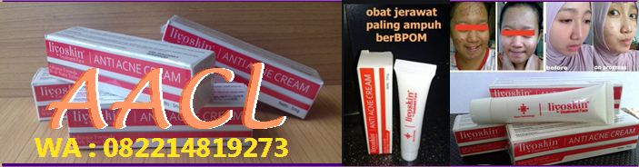 Obat penghilang Jerawat Paling ampuh aman