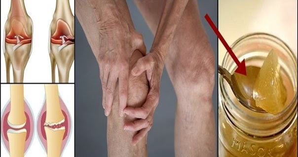 How To Regenerate The Cartilage Of The Knee Naturally