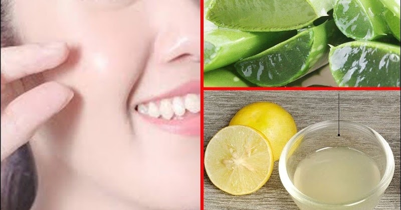 Cara Simple Membuat Masker Lidah Buaya Untuk Kulit Dan Rambut Cantik Millenial