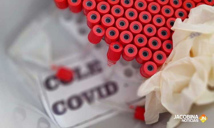Jacobina confirma mais 30 casos de Covid-19 e 44 recuperados
