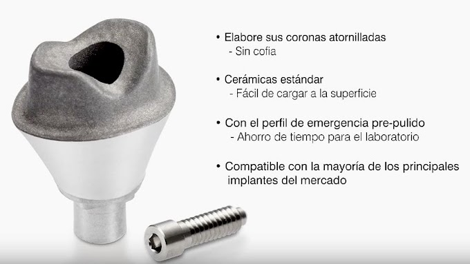 IMPLANTES DENTALES: LaserAbutments RENISHAW - Pilares personalizados para Implantes en 3D