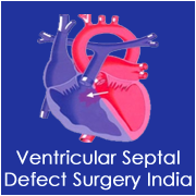 Ventricular Assist Device Surgery India