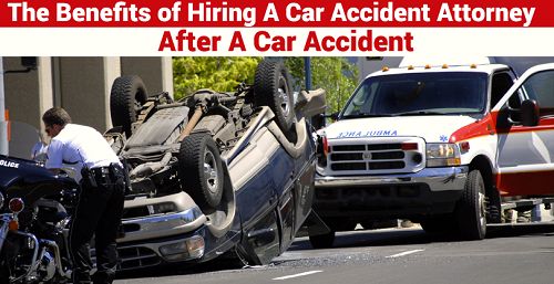 Image When to Hire an Attorney after a Car Accident 1 Image When to Hire an Attorney after a Car Accident