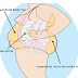 REMOVE THE FAT AND ESPECIALLY GET RID OF BELLY FAT