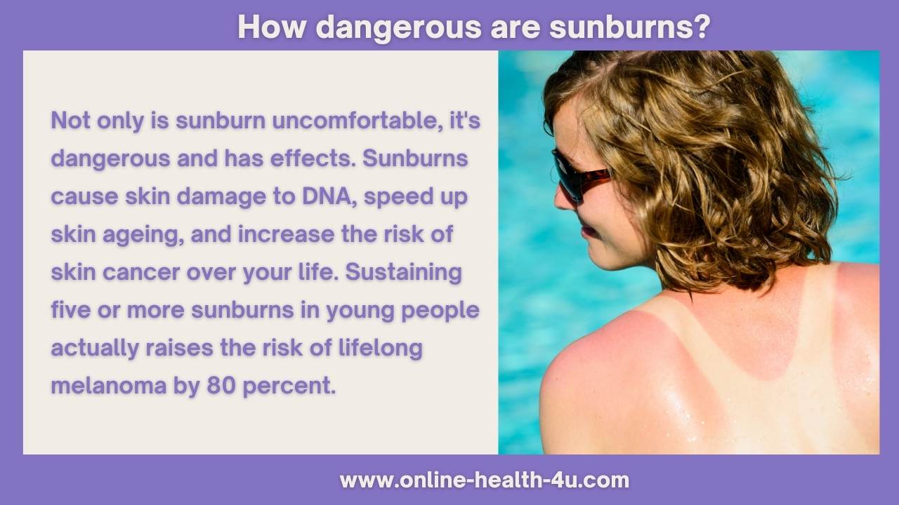 sunburn-Symptoms-Signs-causes-treatments