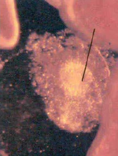 Foto mikroskopis menunjukkan sel telur yang dihasilkan oleh ovarium, dan akan memulai perjalanan melewati saluran telur