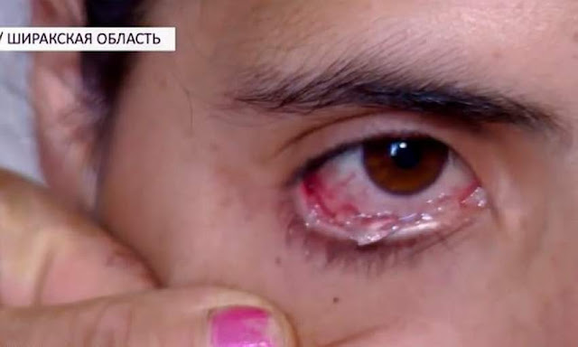 امرأة تبكي دموع كريستالية يوميًا