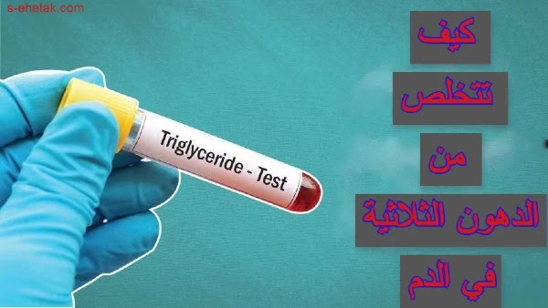 كيف تتخلص من الدهون الثلاثية في الدم كيف تتخلص من الدهون الثلاثية في الدم