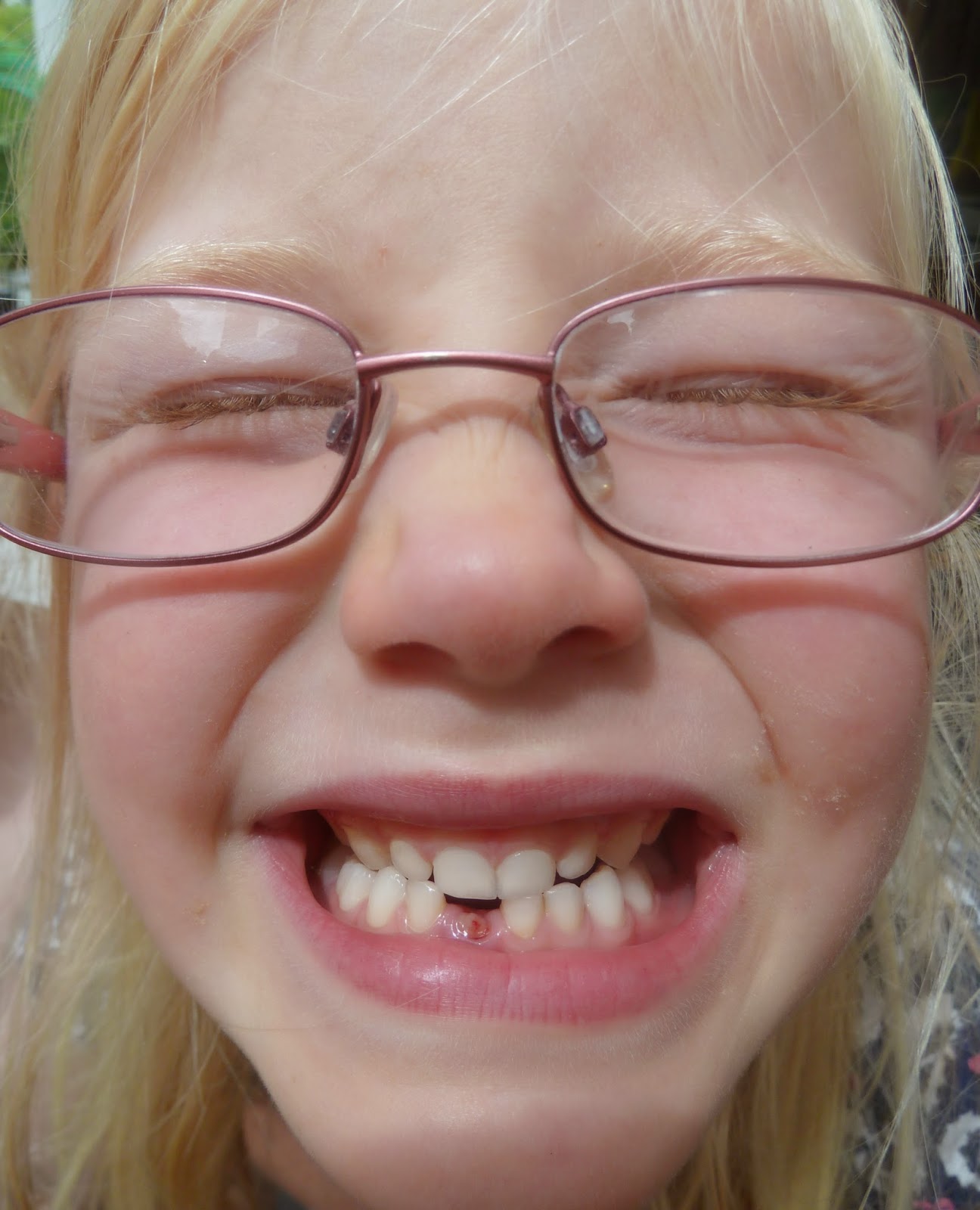 QWERTY Mum Attention! Attention! My wobbly tooth will come out today!