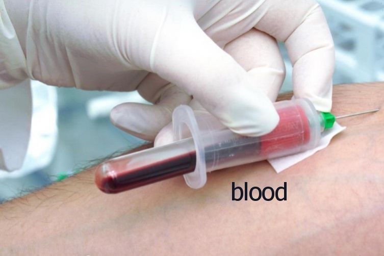 حقن الدم الذاتي يعزز المناعة بشكل طبيعي