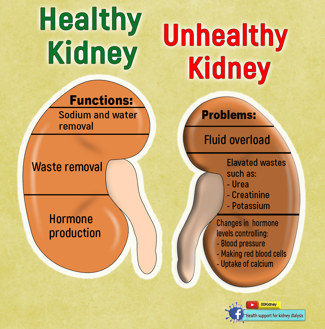 Is It Really Possible To Get Off Kidney Dialysis How Do Kidneys Work