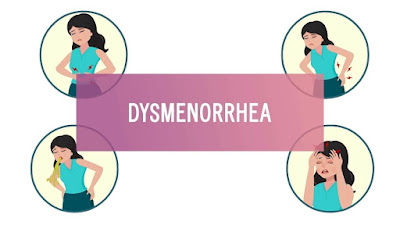 Dysmenorrhea: